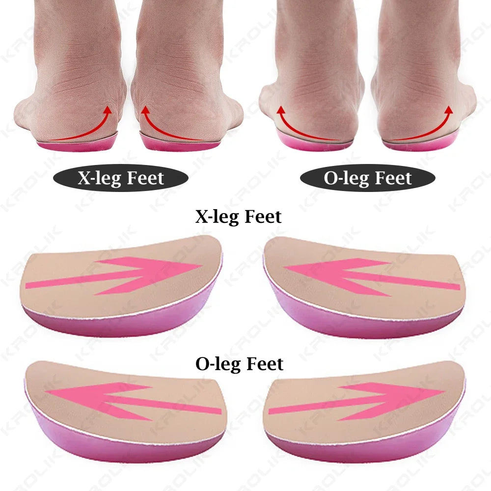 KROLIK 1 Pair Orthopedic Insole Shoe Insert Medial & Lateral Heel Wedge Lift Silicone Pads Corrective O/X Type Leg for Women/Men